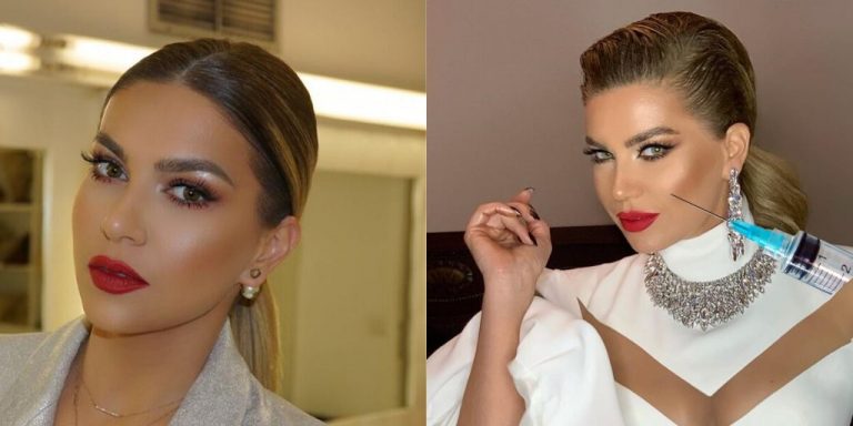 ‘Fytyrën si me ia picku bleta’, por Leonora Jakupi e mohon se ka bërë operacione plastike