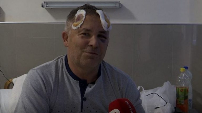 Lëndohet rëndë polici derisa ishte në detyrë nga erërat e forta në Istog