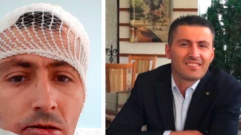 Sulm brutal ndaj kryeinspektorit në Mitrovicë, po trajtohet në QKUK