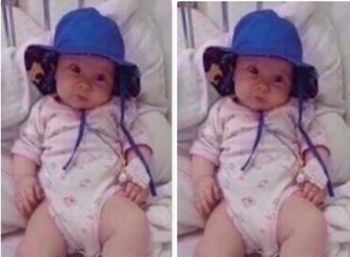 Alea 6 muajshe ka nevojë për ndihmë, nevojiten edhe 11 mijë euro për shërimin e saj