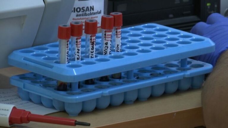 Nga sot, testin për koronavirus mund ta bëni në laboratore private: Këto janë çmimet