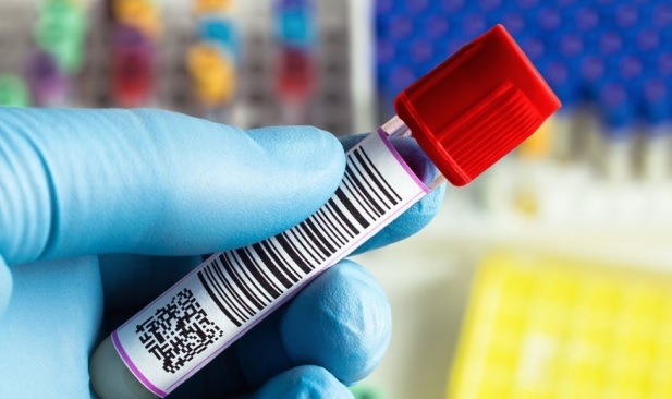 Vazhdon licencimi i laboratorëve privat për COVID-19