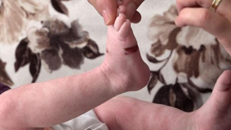 Kjo komunë në Kosovë u jep çifteve për foshnjat nga 200 euro