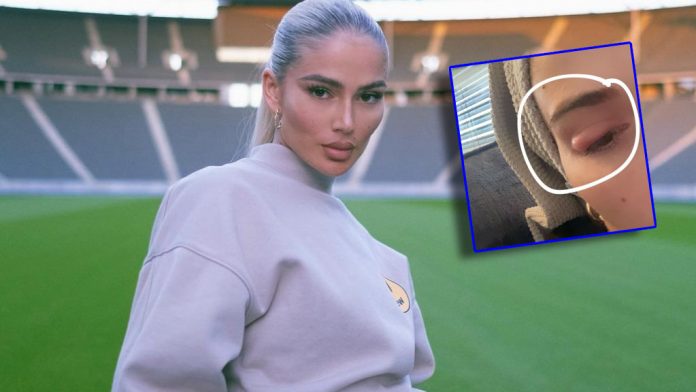 Ditë jo edhe e mirë për Loredana Zefin i ndodh e papritura