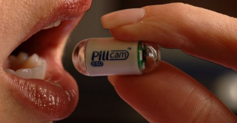 Pacientët mund të gëlltisin pilulën me kamerë për ta identifikuar kancerin