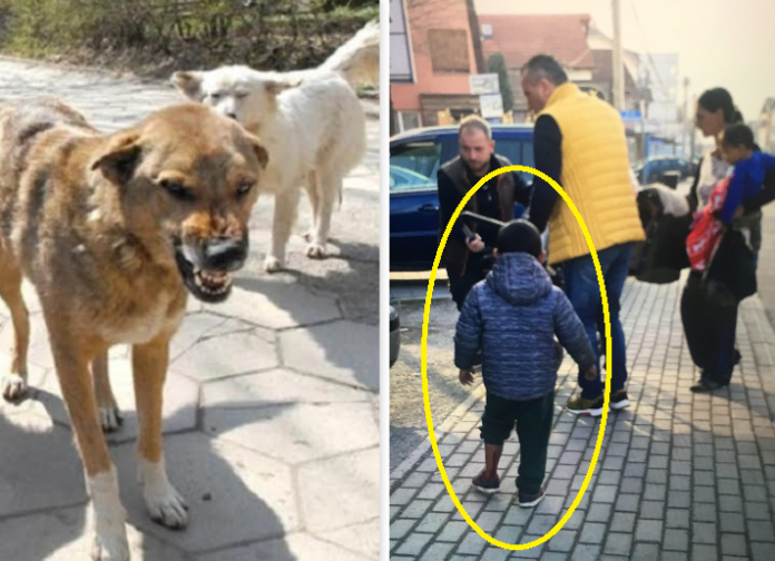 Qeni endacak kafshon fëmijën në Ferizaj, i shkakton lëndime në këmbë