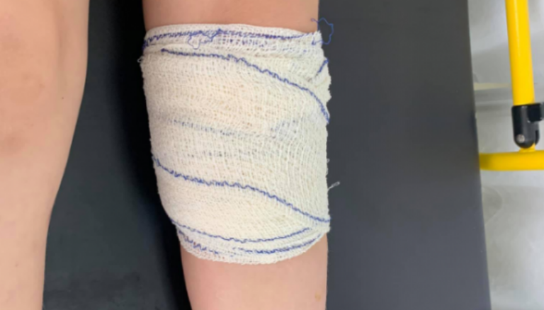 Djali i Mimoza Kusarit sulmohet nga qentë endacakë