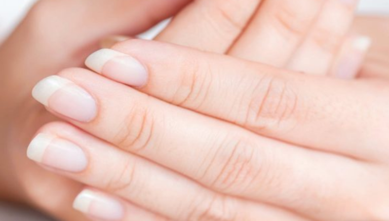 Shenjat në thonj që tregojnë nëse e keni kaluar koronavirusin