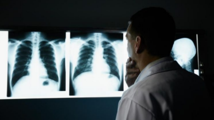 Organet pa të cilat mund të jetojmë