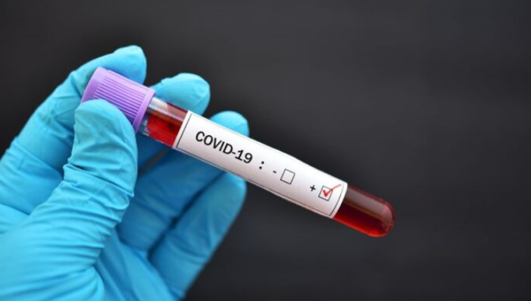 Arrestohet mjeku specialist, dyshohet se falsifikonte testet e Covid 19