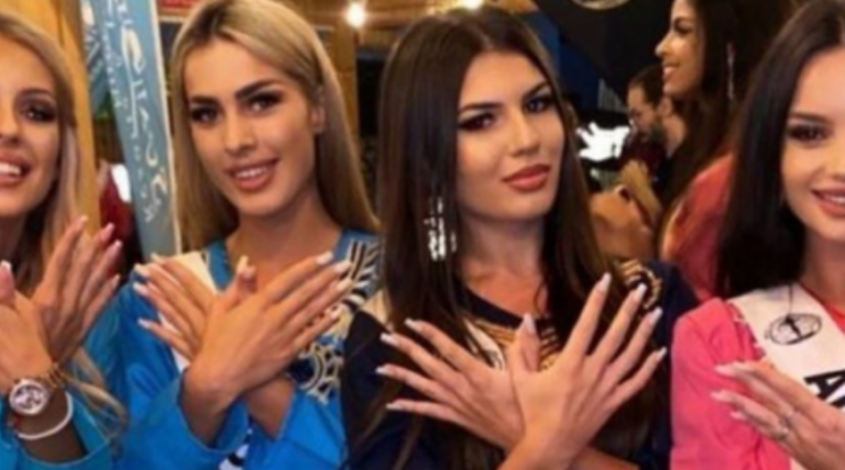 Miss Serbia po trajtohet me infuzion, veç pse e bëri shqiponjën!