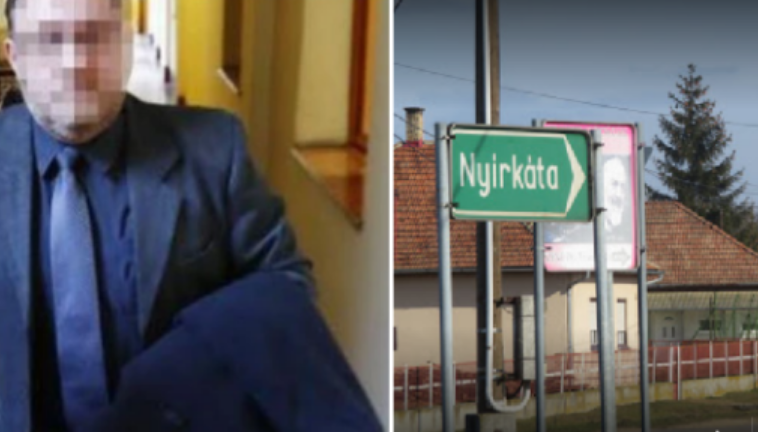 Burri këput qëllimisht dy këmbët poshtë trenit për të përfituar sigurimet $2.5 milionë