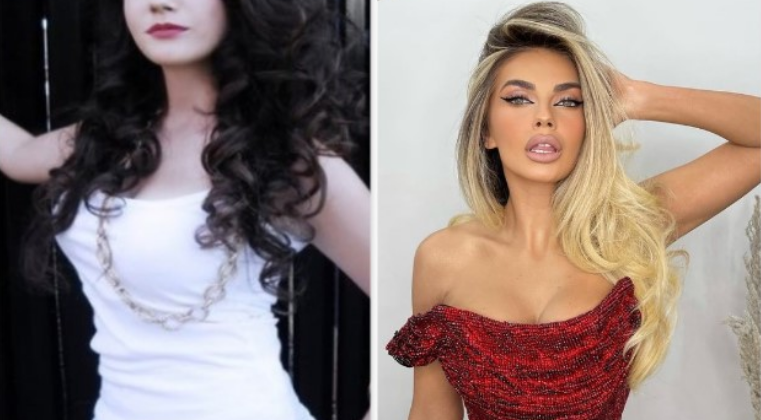 Mezi njihet, Beatrix Ramosaj para operacioneve plastike