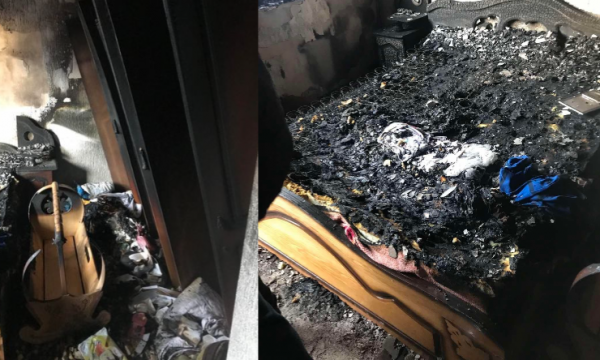 Vdes 3-vjeçari nga Ferizaj që pësoi djegie të rënda nga zjarri