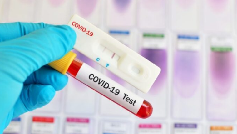 Mërgimtares nga Zvicra i kushtoi shtrenjtë testi COVID-19 i falsifikuar në Kosovë