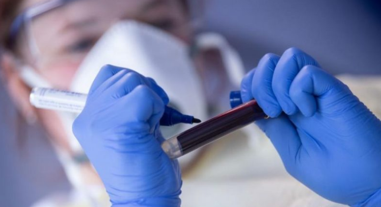 Konfirmohet rasti i parë me ‘Florona’, gripi sezonal kombinohet me virusin korona