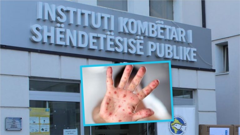 Rritja e rasteve të fruthit në Evropë, Kosova s’ka asnjë rast të konfirmuar